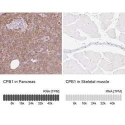 Carboxypeptidase B1/CPB1 Antibody, Novus Biologicals 0.1mL; Unlabeled:Antibodies,